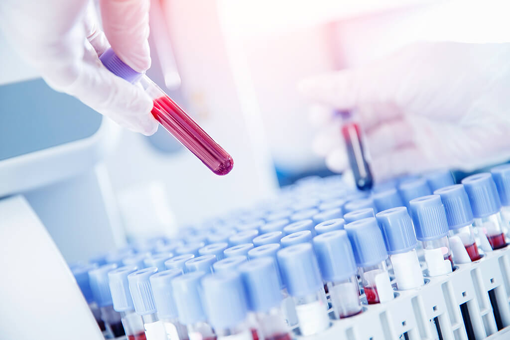 Vaccines Titers | NY Best Medical Testing | New York Vaccines